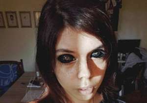 给美女染色(波兰美女赶时髦竟去染色眼球，手术失误致失明，双眼漆黑如丧尸)